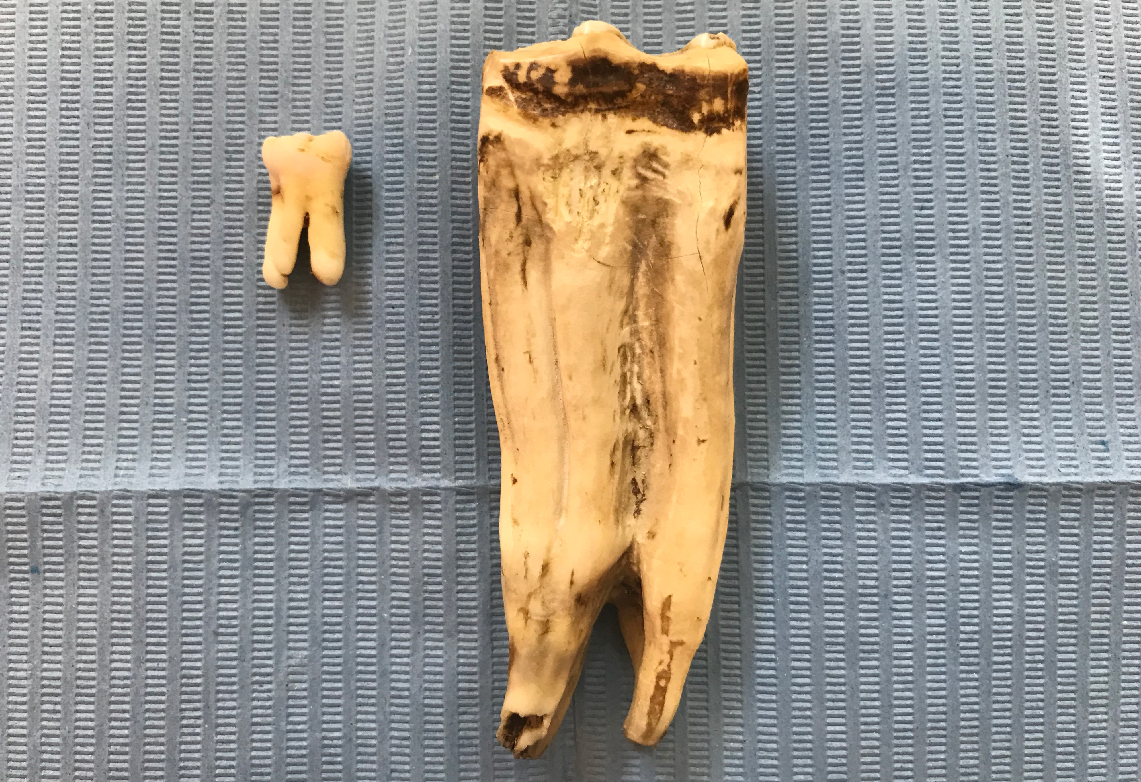 human versus equine tooth