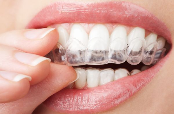 flexible comfortable teeth whitening trays