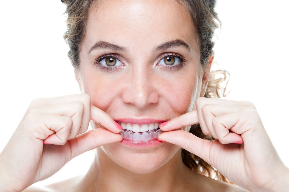 Invisalign blog looking for a straighter smile